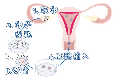 陈若晴 副院长